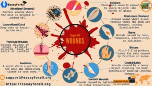 Wound Management Reflection Essay
